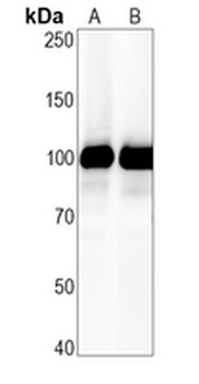 CD10 Rabbit Monoclonal Antibody