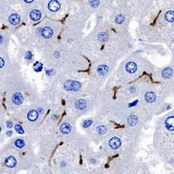CD10 Rabbit Monoclonal Antibody