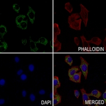 CD10 Rabbit Monoclonal Antibody