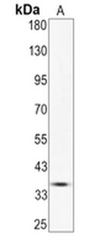 Calponin 1 Rabbit Monoclonal Antibody