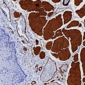 Calponin 1 Rabbit Monoclonal Antibody