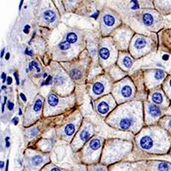 Caldesmon Rabbit Monoclonal Antibody