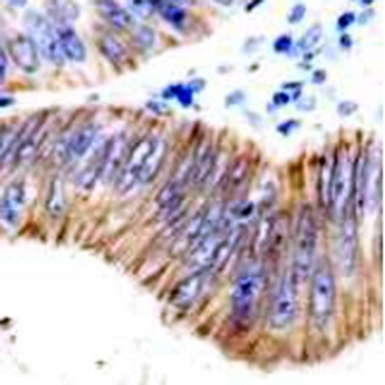 LI Cadherin Rabbit Monoclonal Antibody