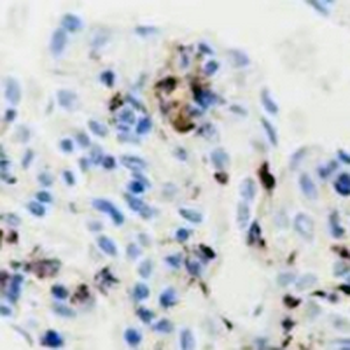 C4b Rabbit Monoclonal Antibody