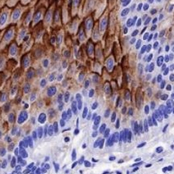 LYPD3 Rabbit Monoclonal Antibody