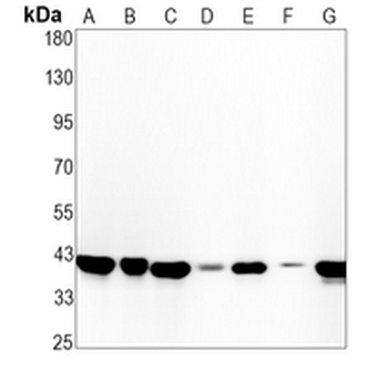 Beta-actin Rabbit Monoclonal Antibody