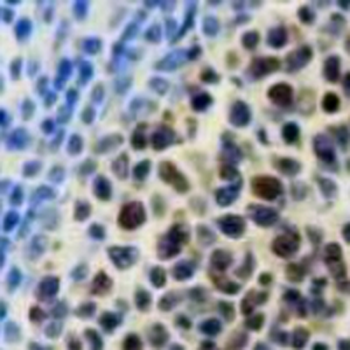 BCL6 Rabbit Monoclonal Antibody