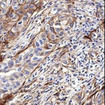 CD276 Rabbit Monoclonal Antibody