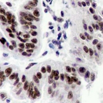 ATM Rabbit Monoclonal Antibody