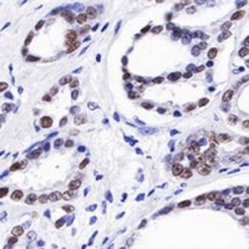 Androgen Receptor Rabbit Monoclonal Antibody