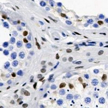 Androgen Receptor Rabbit Monoclonal Antibody