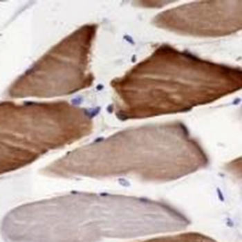 Alpha-crystallin B Rabbit Monoclonal Antibody
