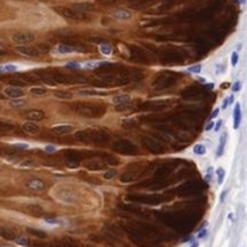ALDH3A1 Rabbit Monoclonal Antibody