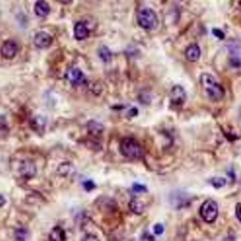 ALDH1A1 Rabbit Monoclonal Antibody