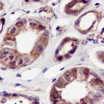 Calpain Rabbit Monoclonal Antibody