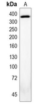 Ki67 Rabbit Monoclonal Antibody