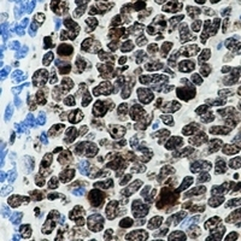 Ki67 Rabbit Monoclonal Antibody