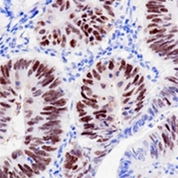 p53 Rabbit Monoclonal Antibody