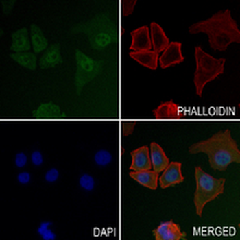 p53 Rabbit Monoclonal Antibody