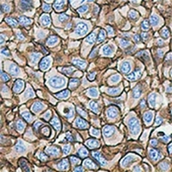 HER2 Rabbit Monoclonal Antibody