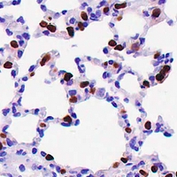 NKX2-1 Rabbit Monoclonal Antibody