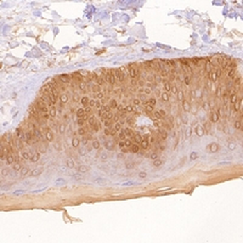 Cytokeratin 5 Rabbit Monoclonal Antibody