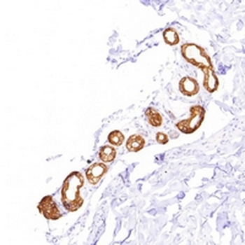 Cytokeratin 8 Rabbit Monoclonal Antibody