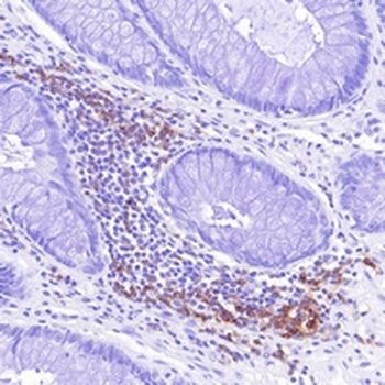 CD4 Rabbit Monoclonal Antibody