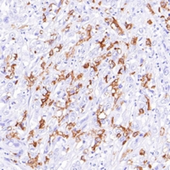 CD1a Rabbit Monoclonal Antibody