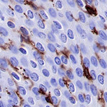 CD1a Rabbit Monoclonal Antibody