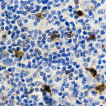 CD134 Rabbit Monoclonal Antibody