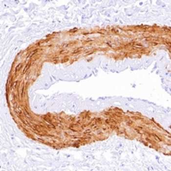 Calponin 1 Rabbit Monoclonal Antibody