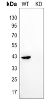 Beta-actin Rabbit Monoclonal Antibody