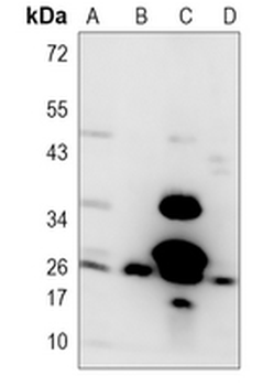 BCL2 Rabbit Monoclonal Antibody