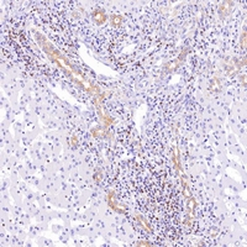 BCL2 Rabbit Monoclonal Antibody