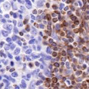 BCL2 Rabbit Monoclonal Antibody