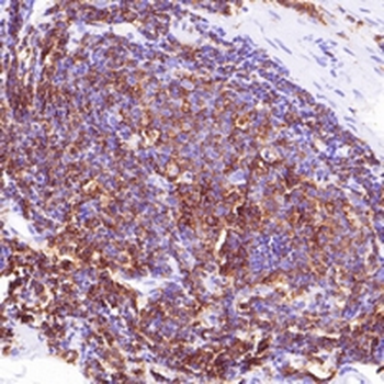 Alpha-fetoglobulin Rabbit Monoclonal Antibody