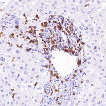 CD8a Rabbit Monoclonal Antibody