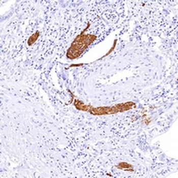 CD10 Rabbit Monoclonal Antibody