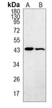 Smooth Muscle Actin Rabbit Monoclonal Antibody