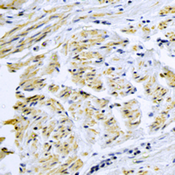 Smooth Muscle Actin Rabbit Monoclonal Antibody