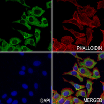 Smooth Muscle Actin Rabbit Monoclonal Antibody