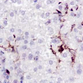 Smooth Muscle Actin Rabbit Monoclonal Antibody