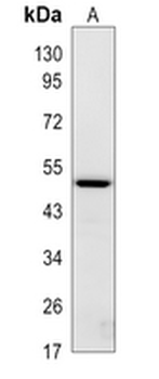 CD274 Rabbit Monoclonal Antibody