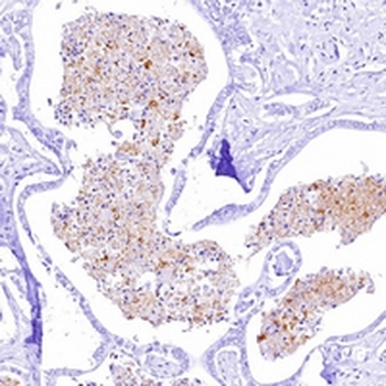 CD274 Rabbit Monoclonal Antibody