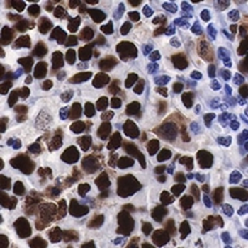 MCM2 Rabbit Monoclonal Antibody