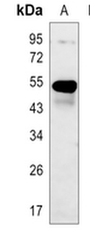 Cytokeratin 7 Rabbit Monoclonal Antibody