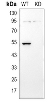 Cytokeratin 7 Rabbit Monoclonal Antibody