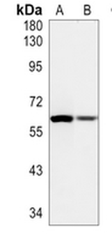 Cytokeratin 5 Rabbit Monoclonal Antibody