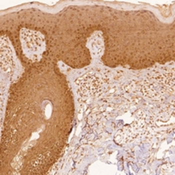 Cytokeratin 5 Rabbit Monoclonal Antibody